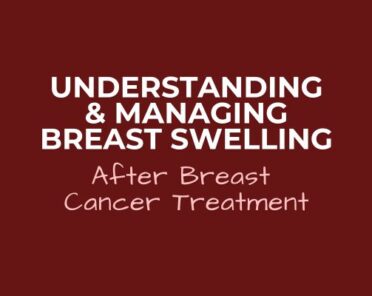 Understanding and Managing Breast Swelling